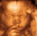 3D Image of a fetus